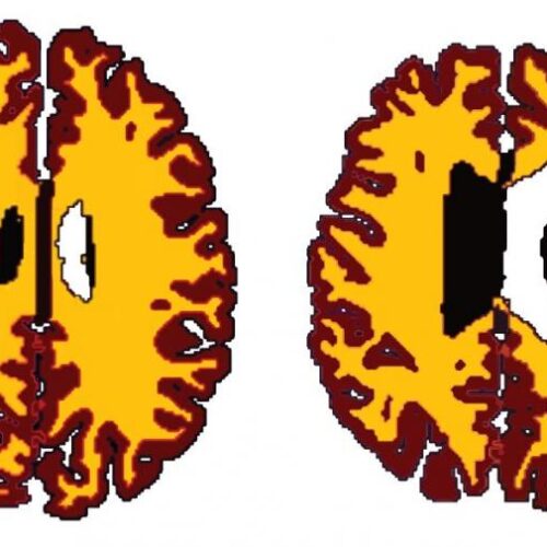 Il cervello di un oversize? E’ più vecchio di 10 anni