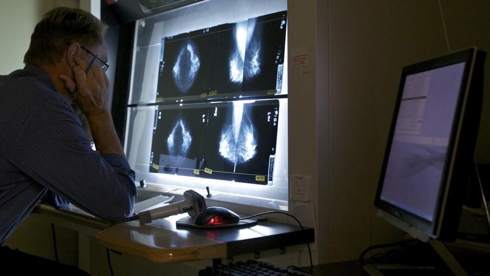 Tumore al seno, trattamenti meno tempestivi nelle over 70